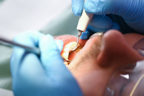 Best Emergency Dental Care for Broken or Chipped Teeth in Waukee, IA